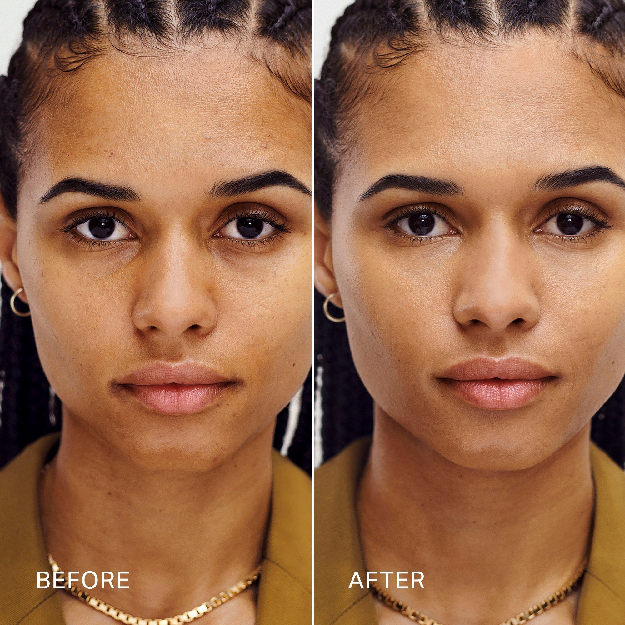 Master || Before, After